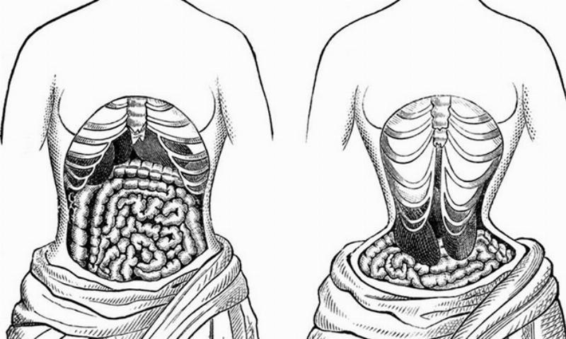 Lợi Ích và Tác Hại của Việc Đeo Đai Nịt Bụng