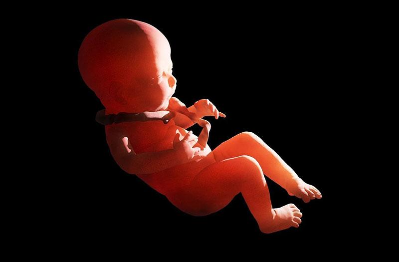 Siêu âm phát hiện dây rốn quấn cổ