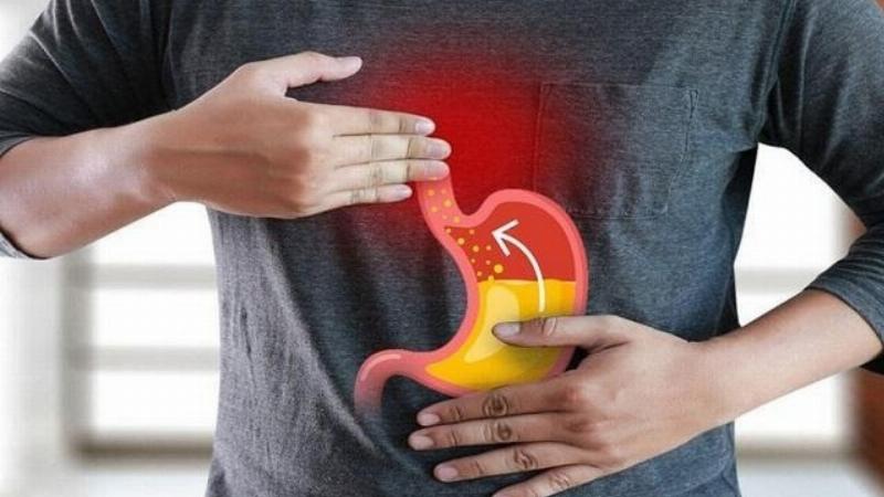 Thuốc dạng viên trào ngược dạ dày
