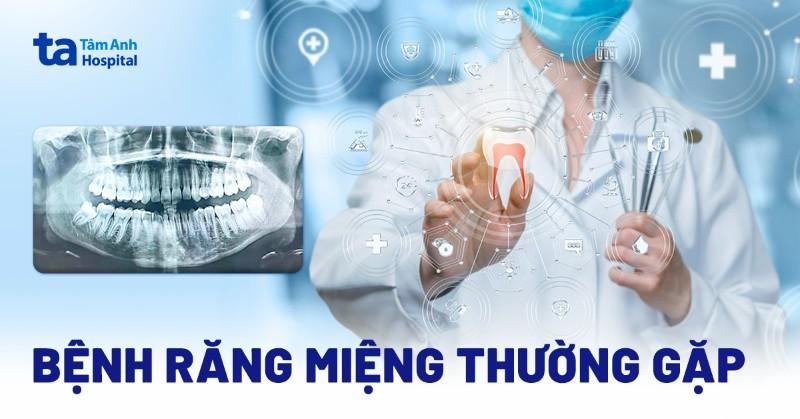 nhan-biet-cac-trieu-chung-benh-rang-mieng
