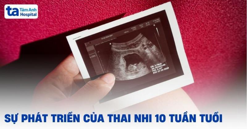 Hình ảnh siêu âm thai 10 tuần
