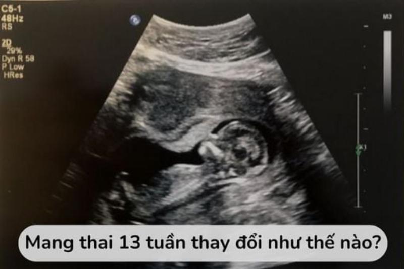 Lời khuyên cho mẹ bầu 13 tuần