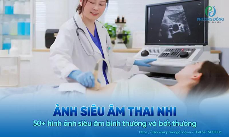 Hinh anh sieu am thai nhi 4 tuan tuoi showing tui thai va tui noan hoang