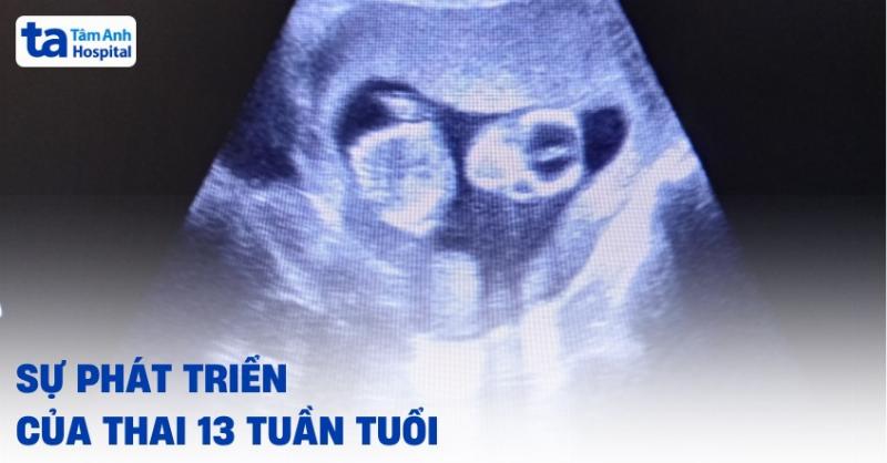 Tâm trạng mẹ bầu 13 tuần