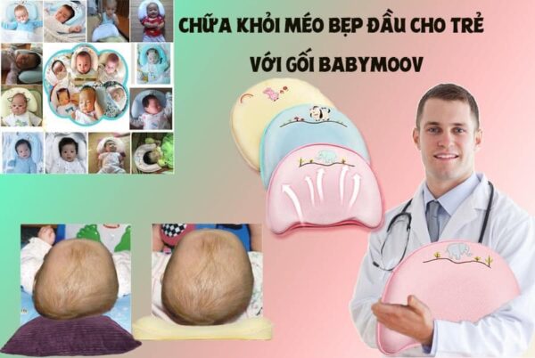 GỐI CHỐNG MÉO ĐẦU BABY MOOV