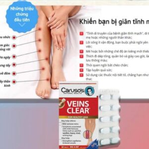 Kem Bôi Giãn Tĩnh Mạch Carusos Veins Care Cream 75Gr Của Úc