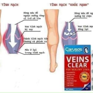 Kem Bôi Giãn Tĩnh Mạch Carusos Veins Care Cream 75Gr Của Úc