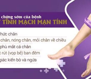 Kem Bôi Giãn Tĩnh Mạch Carusos Veins Care Cream 75Gr Của Úc