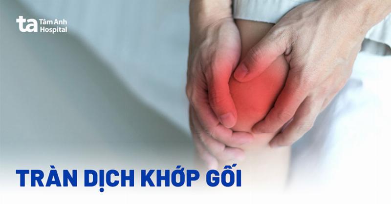 Phòng ngừa tràn dịch khớp gối cho bé